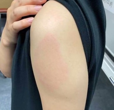 モデルナのほうが副反応はつらい けどデルタ株への効果は高い ファイザーとの差はわずかだから どちらでもよいからワクチンを早く打とう 新発田市耳鼻科の医療豆知識